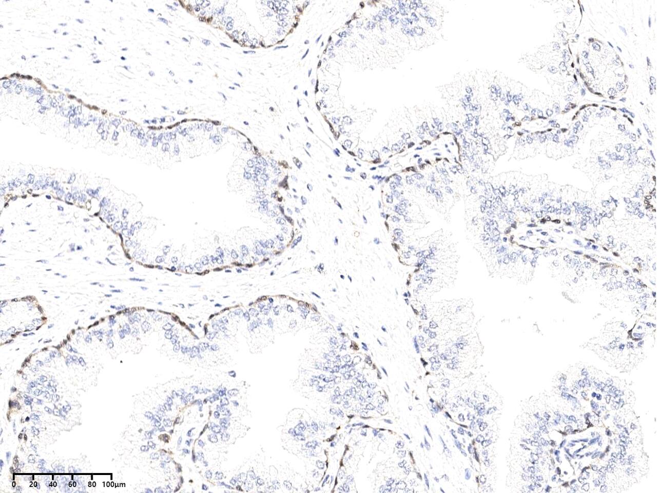 Kallikrein 15 Antibody (02) - Azide and BSA Free