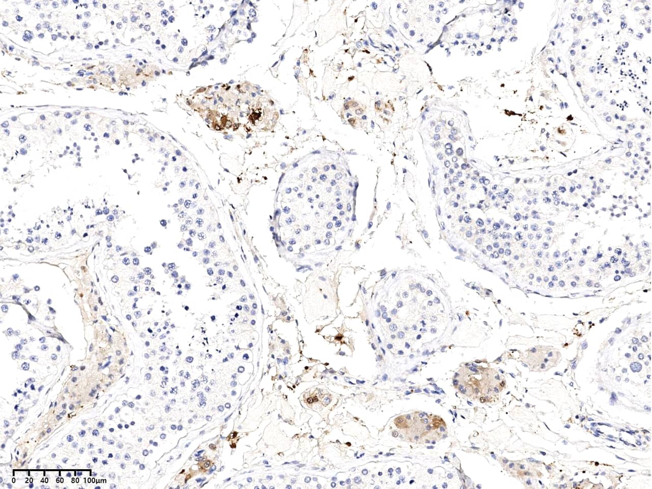 Kallikrein 15 Antibody (02) - Azide and BSA Free