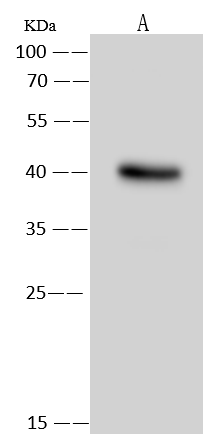 PPP1R3C Antibody - Azide and BSA Free