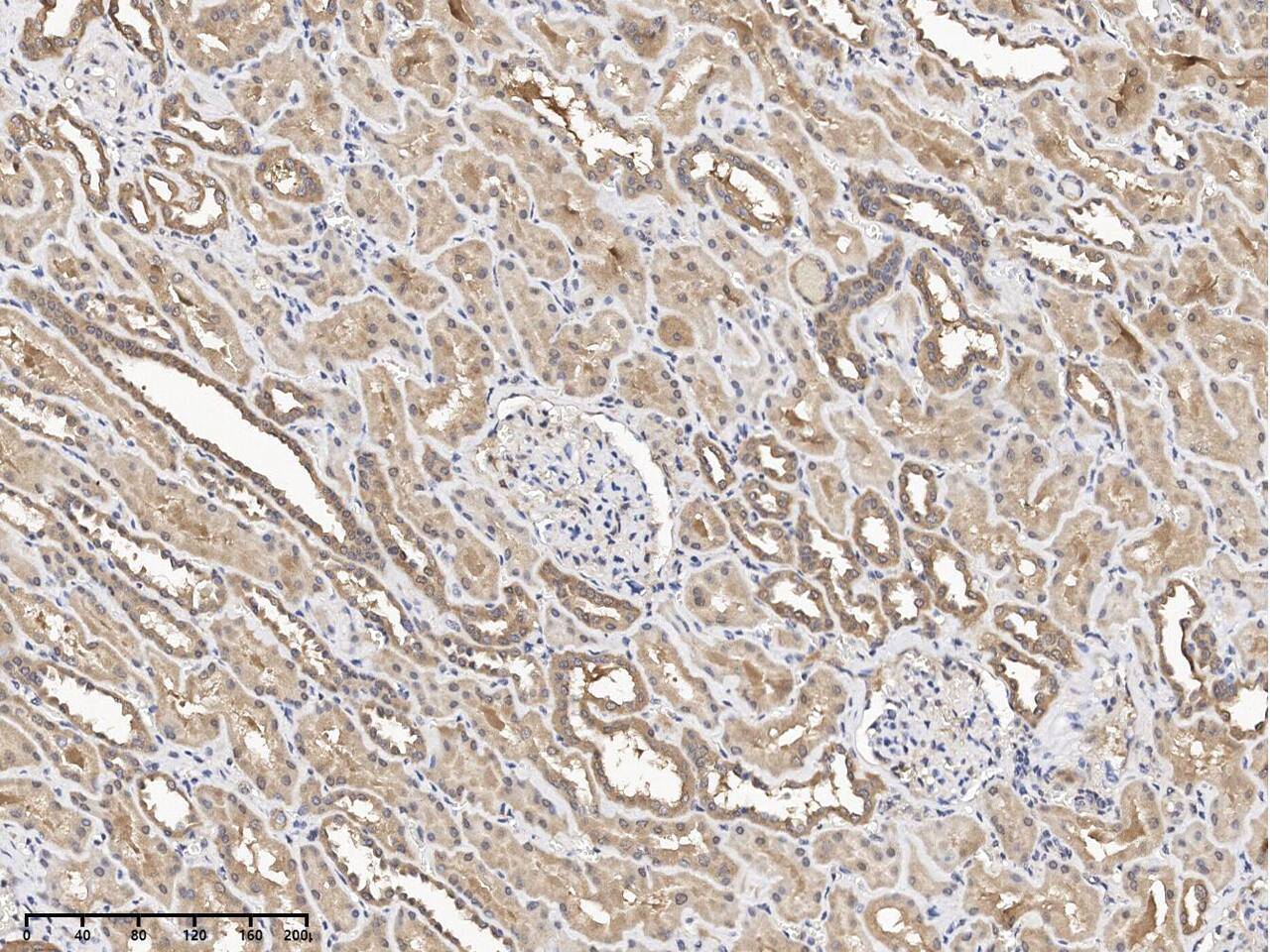 FIGNL1 Antibody - Azide and BSA Free