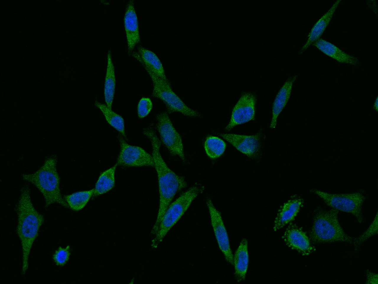 Adenylosuccinate Lyase Antibody (05) - Azide and BSA Free