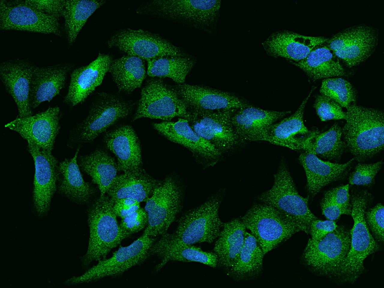 FTSJ1 Antibody - Azide and BSA Free