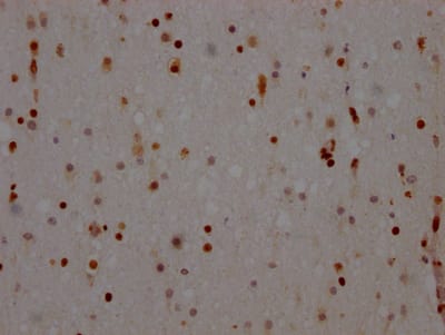 NONO Antibody (8C11)