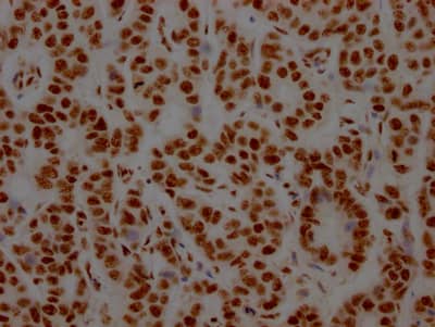NONO Antibody (8C11)