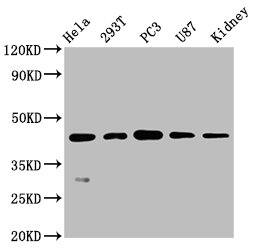 NDRG1 Antibody (4C8)
