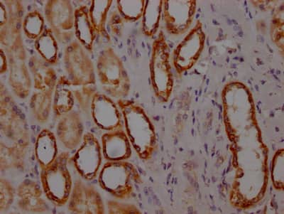 MYBBP1A Antibody (3A1)