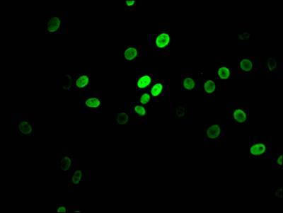 MYBBP1A Antibody (3A1)