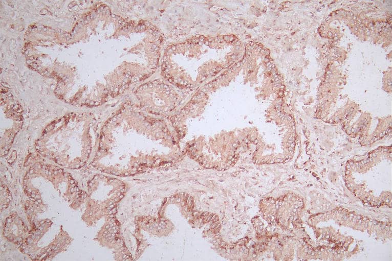 M-Ras/R-Ras3 Antibody (26E12)