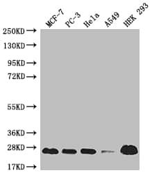 M-Ras/R-Ras3 Antibody (18E11)