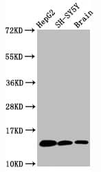 Histone H3.1 [Monomethyl Lys36] Antibody (1F4)