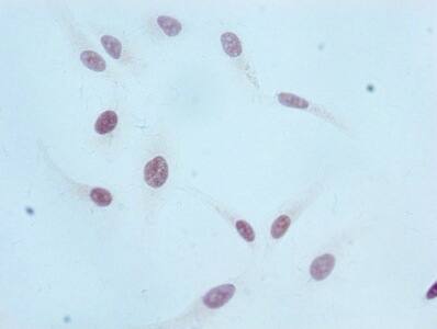 Histone H3.1 [Monomethyl Lys36] Antibody (1F4)