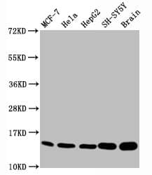 Histone H3.1 [Monomethyl Lys18] Antibody (2B5)