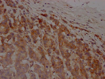 MMP-12 Antibody (2G3)