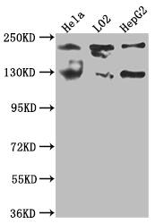 O-GlcNAcase/OGA/MGEA5 Antibody (8D12)