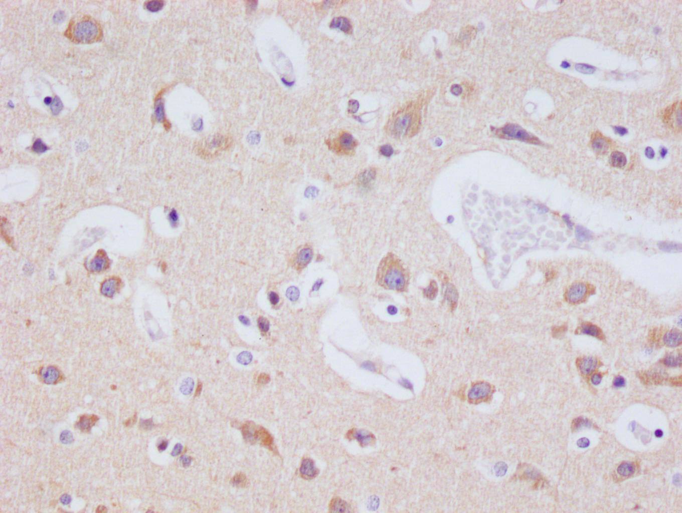 JNK3 Antibody (29E10)