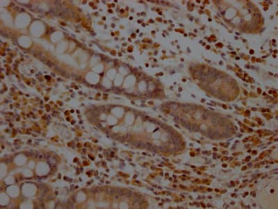 MEK1 Antibody (3F10)