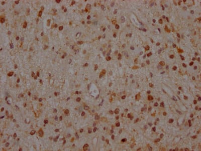 MEK1 Antibody (9B6)
