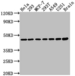 MEK1 Antibody (9B6)