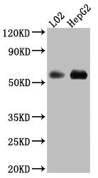 Monoamine Oxidase B Antibody (9B6)