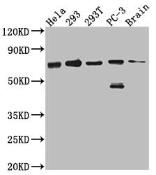 Leukotriene A4 Hydrolase/LTA4H Antibody (6G7)