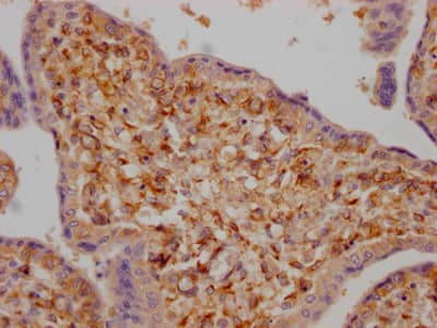 Lysyl Oxidase Homolog 2/LOXL2 Antibody (2E5)