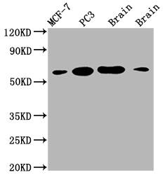 Lysyl Oxidase Homolog 2/LOXL2 Antibody (2E5)