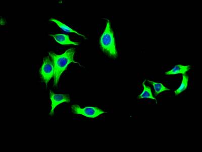 Lysyl Oxidase Homolog 2/LOXL2 Antibody (2E5)