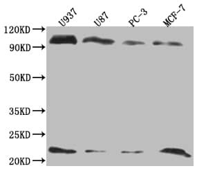 LMO2 Antibody (9H9)