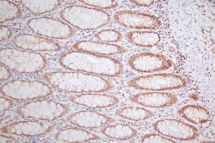 LEF1 Antibody (13B7)