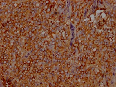 LDLR Antibody (2B10)