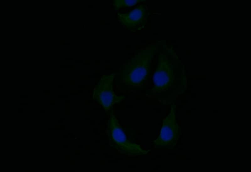 Cytokeratin 6a Antibody (21E2)