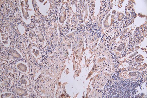 Cytokeratin 20 Antibody (17A11)