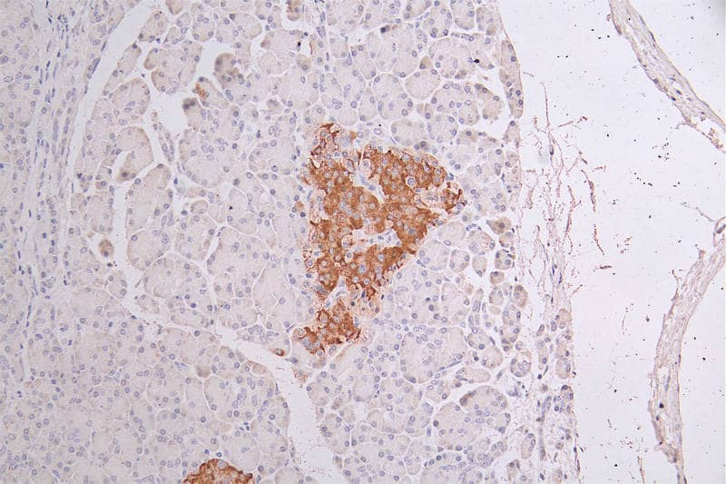 Cytokeratin 10 Antibody (18B6)