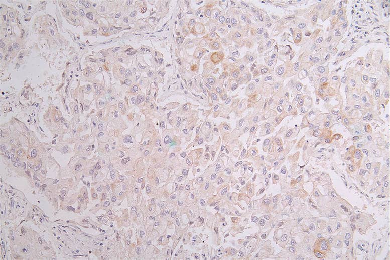 Cytokeratin 10 Antibody (18B6)