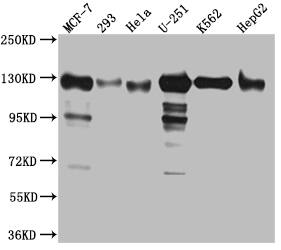 Eg5 Antibody (1G11)