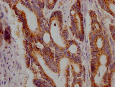 Jak1 Antibody (7A5)