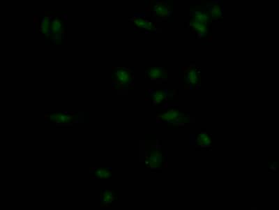 Insulin R/CD220 Antibody (4B2)