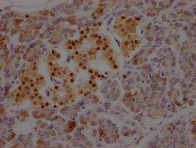 Islet-1 Antibody (1A1)
