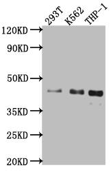 Islet-1 Antibody (1A1)