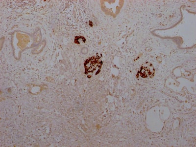 Insulin Antibody (1F6)