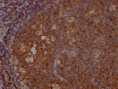 SHIP Antibody (9G11)