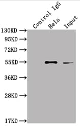 ILK Antibody (6A5)