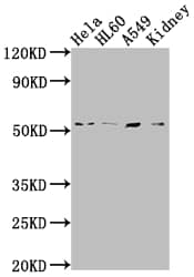 ILK Antibody (6A5)