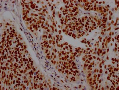 ILF3 Antibody (7H8)