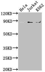 IKK beta Antibody (5D12)