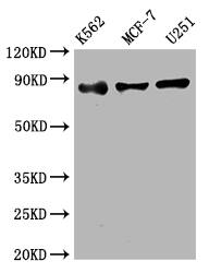 IKK beta Antibody (3E1)