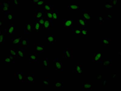IKK beta Antibody (3E1)