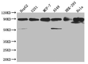 HSP90 beta Antibody (7G7)