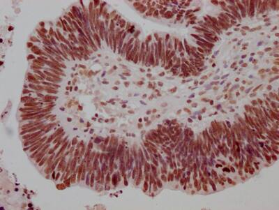 HSF1 Antibody (5C7)