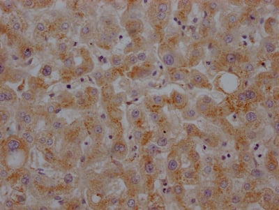 Haptoglobin Antibody (5A5)
